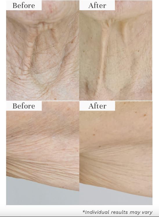 City Beauty InvisiCrepe Body Balm - Skin Firming & Tightening Lotion for a Smoother, Firmer Look | Anti-Aging Firming Body Cream 5 Fl Oz (Pack of 1)
