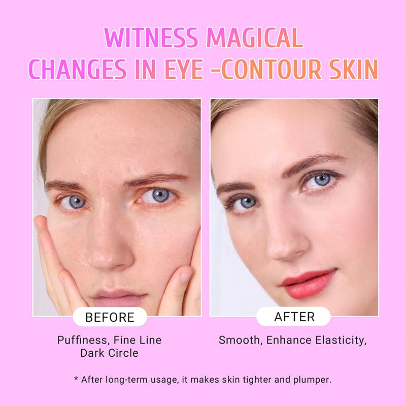 [Australia] - Under Eye Patches (30 Pairs) Gold Eye Mask and Hyaluronic Acid Eye Patches for puffy eyes,Rose Eye Masks for Dark Circles and Puffiness under eye skin care Smooth Wrinkles products 
