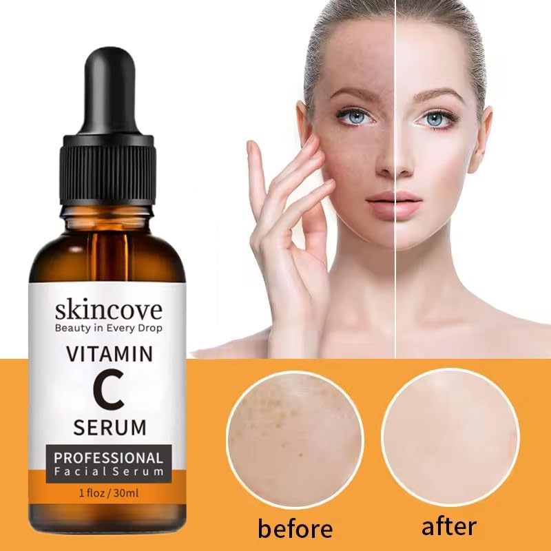 Skincove Vitamin C Serum Anti Aging Facial Serum with Vitamin C, Hyaluronic Acid, Vitamin E Brightening Serum Even Skin Tone, Improve Appearance of Dark Spots, Fine Lines & Wrinkles, 1 Fl Oz