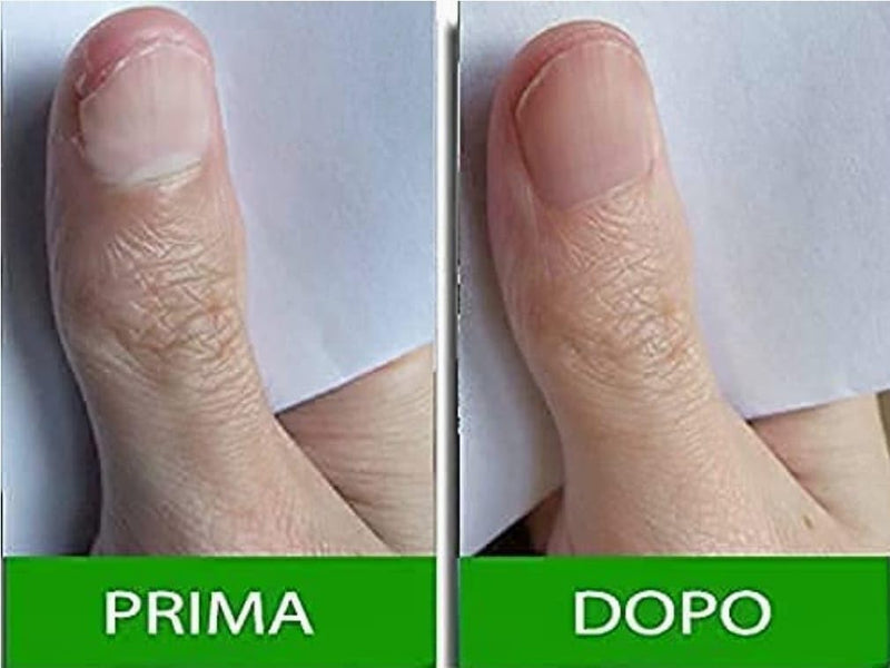 Pantogar Specific Treatment for Hair and Nails 90 caps