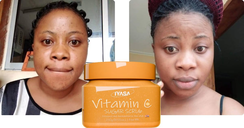 IYASA Vitamin C Sugar Scrub for Daily Exfoliation | Helps Remove Dead Surface and Supports Smoother-Feeling Skin | Refreshing Cleanse | Suitable for Melanin-Rich Skin | 17.9 oz