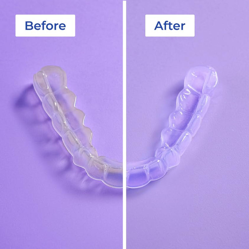 [Australia] - ALIGNER Cleaner Rinse | Concentrated | Clean INVISIALIGN, retainers, dentures, Mouth Guards | 2 Month Supply, (Pack of 1 - Value of 101 fl.oz), Alcohol Free, Minty & Fresh. Made in USA - Pack of 1 45916 Fl Oz (Pack of 1) 
