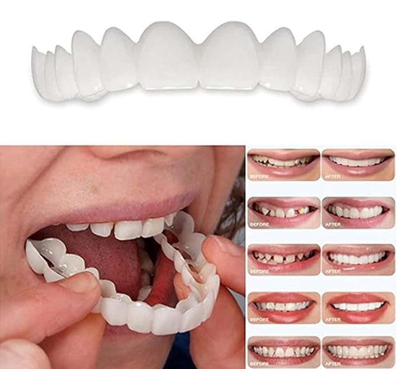 [Australia] - 2 Pairs, Temporary Nature and Comfortable to Regain Confident Smile, Men's and Women's Temporary Confident Smile (1) 1 