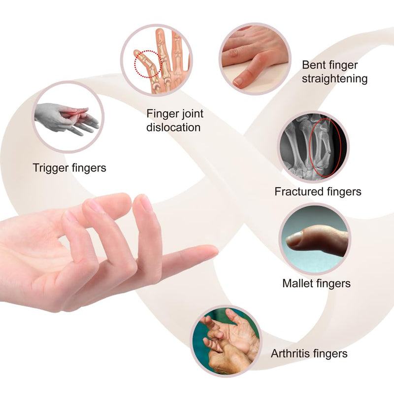 [Australia] - Oval Finger Splint 8 pcs, Finger Splints for Arthritis, Mallet Finger, Trigger Finger Splint, hypermobility(EDS) finger For Thumb/Middle,/Index/Pinky or Ring Finger(2,3,4,5,6,7,8,9) Medium(2,3,4,5,6,7,8,9) 