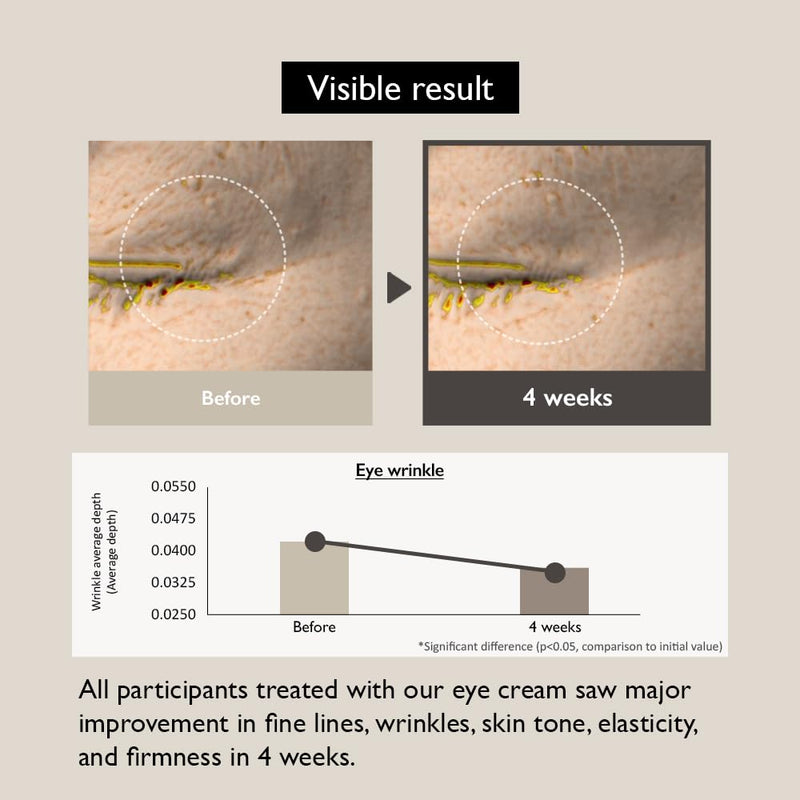 [Australia] - [Haruharu Wonder] Black Rice Bakuchiol Eye Cream 0.67 fl.oz / 20ml | Anti-Aging, Wrinkle Care, Natural Retinol Alternative | Cruelty Free, EWG-Green 0.7 Fl Oz (Pack of 1) 