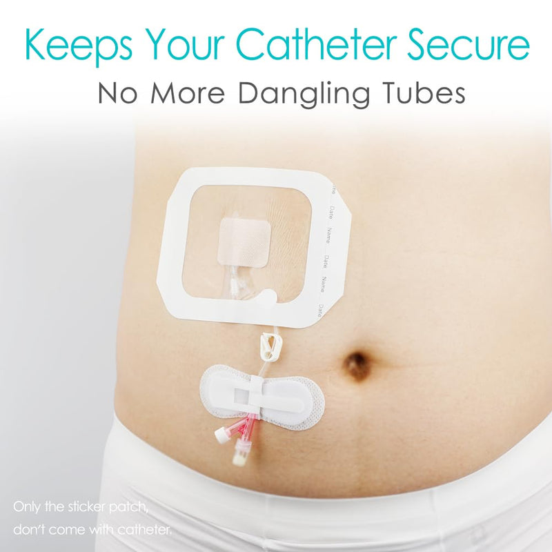 [Australia] - Low-Profile Catheter Stabilization Device for Kids Baby's Gtube Feeding Tube G J Tube Peg Pd Catheter Holder Peritoneal Dialysis Accessories Adhesive Patch Dressing (Pack of 10) Small 10 Pcs 