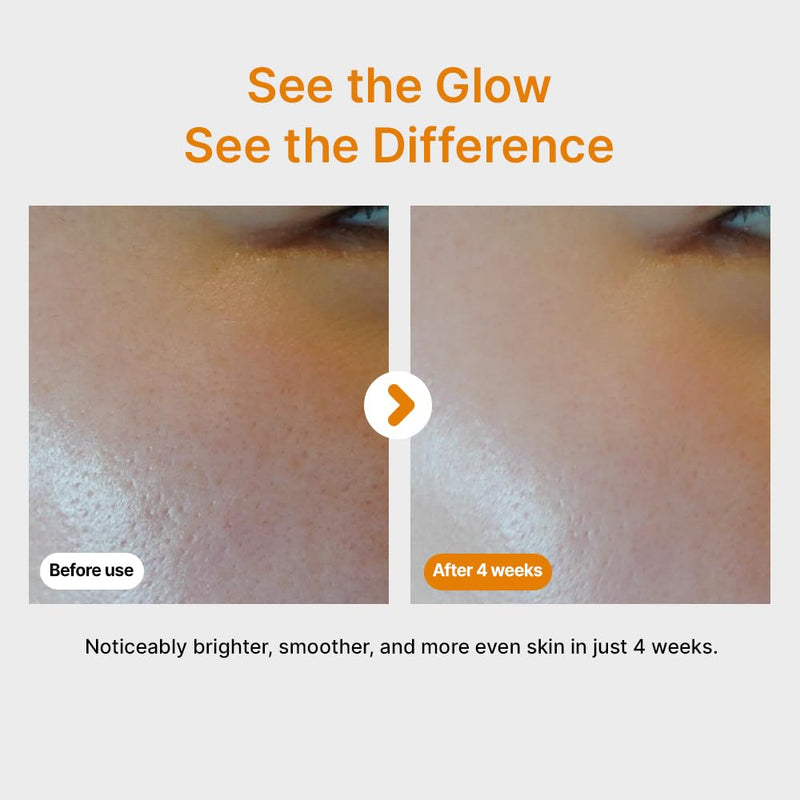 Pure Vitamin C Serum - Korean Skincare with Vitamin 10.5%, Waterless (No oxidation formula), Special Airless Pump, Brightening and Firming Skin, Improving Uneven/Dull Skin Tone, 30ml/1.01fl.oz