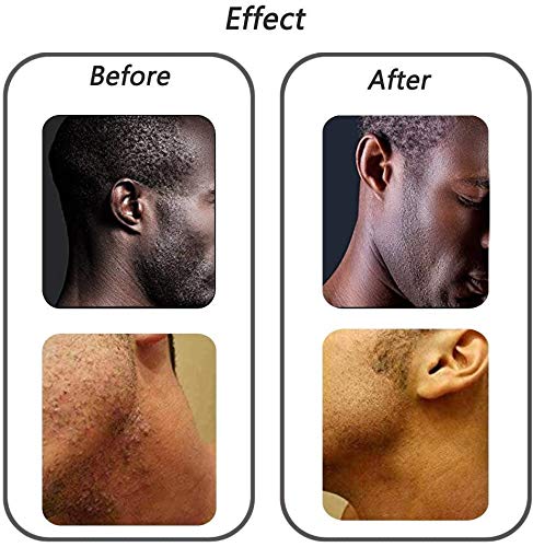 [Australia] - Silky Skin Exfoliating Body Brush for treating and preventing razor bumps and ingrown hairs for men and women, flexible bristle brush to eliminate shaving irritation for face 