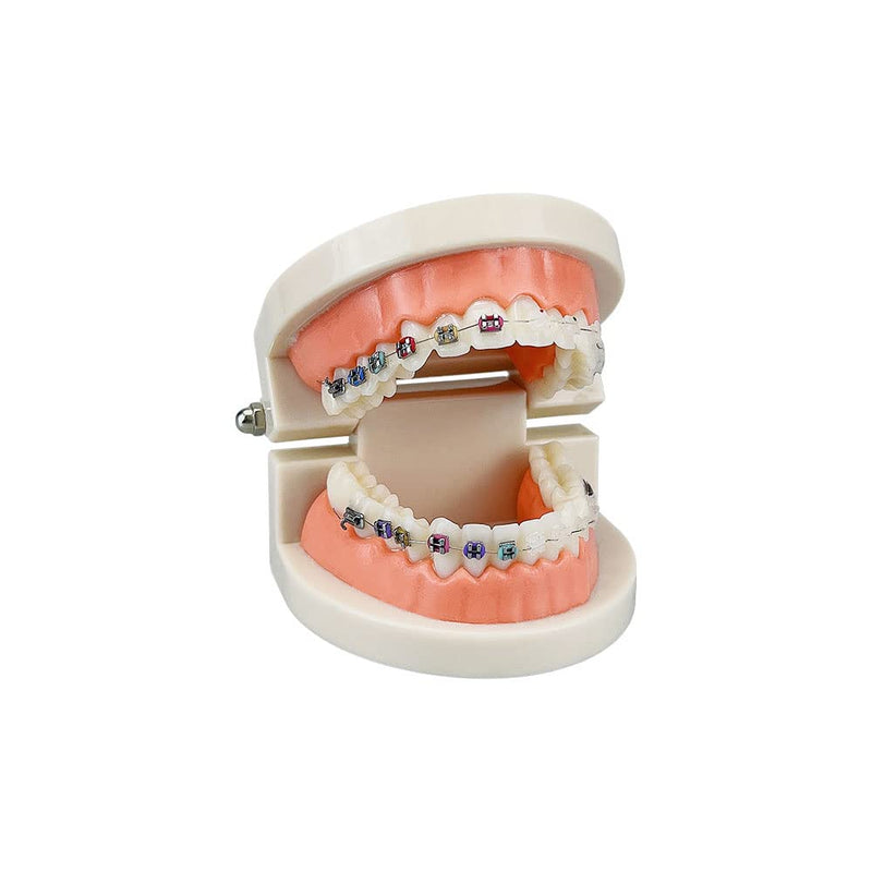 Standard Orthodontic Teeth Model, YOUYA DENTAL Demonstration Orthodontic Model Teeth Teach Study Tools with Metal and Ceramic Bracket(Red) Orthodontic Model - 1/2Metal and 1/2Ceramic