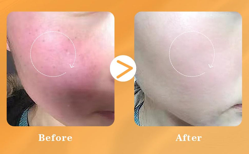 2 PCS Vitamin C Liposomal Face Serum, Instantly Calming, Soothing,Radiance Boosting Anti-Aging, Even Skin Tone with Centella Asiatica, Ceramide, Astaxanthin, Hyaluronic Acid DOUBLE ORANGE