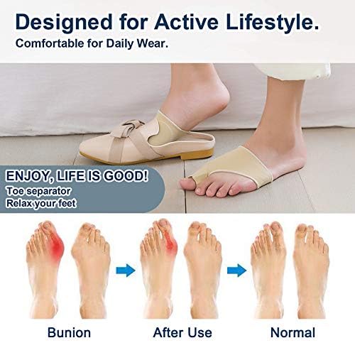 [Australia] - Bunion corrector, bunion splint, 1 pair, support, with integrated silicone gel padding, for pain relief from hallux valgus 