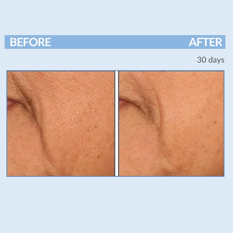 Serious Skincare Vitamin A Cream Retinol Moisturizer For Face 2 Oz (2Pack)