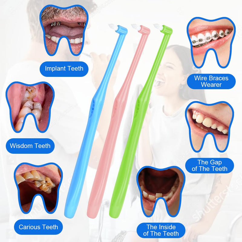 [Australia] - ACWOO Tufted Toothbrush, Pack of 8 Single Tufted Brush Toothbrush Small Toothbrush Tufted Brush Soft Tufted Toothbrush Trim Toothbrush Single Interdental Space Brush for Detail Cleaning 