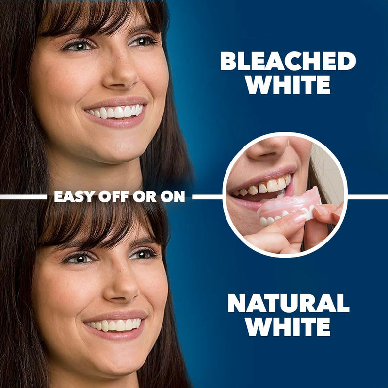 [Australia] - Imako Premium Cosmetic Teeth - 1 Pack - Large, Bleached White - Upper Veneers - Custom Fit at Home, DIY Smile Makeover, Made in USA 