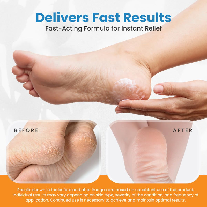 Revitaderm 4D 40% Urea Advanced Foot Cream for Cracked Heels & Dry Skin, Intensive Repair for Rough, Callused Feet, Fast Absorbing, Fragrance Free, Made in USA, 4 oz with Pumice & Brush, 1 Pack 4 Ounce (Pack of 1)