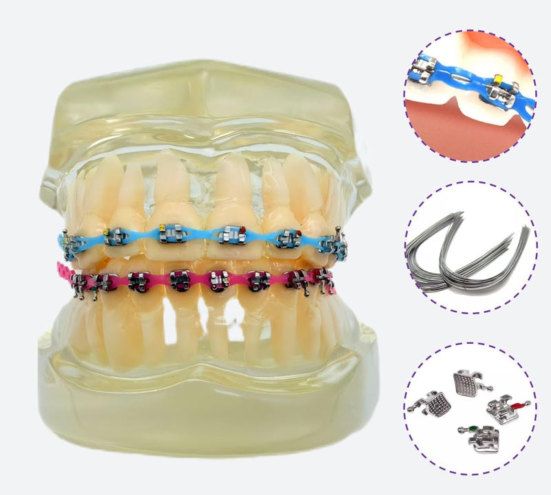 [Australia] - Complete Orthodontic Braces Kit with 20 Color Braces Power Chain for Braces DIY & Replacement at Home 