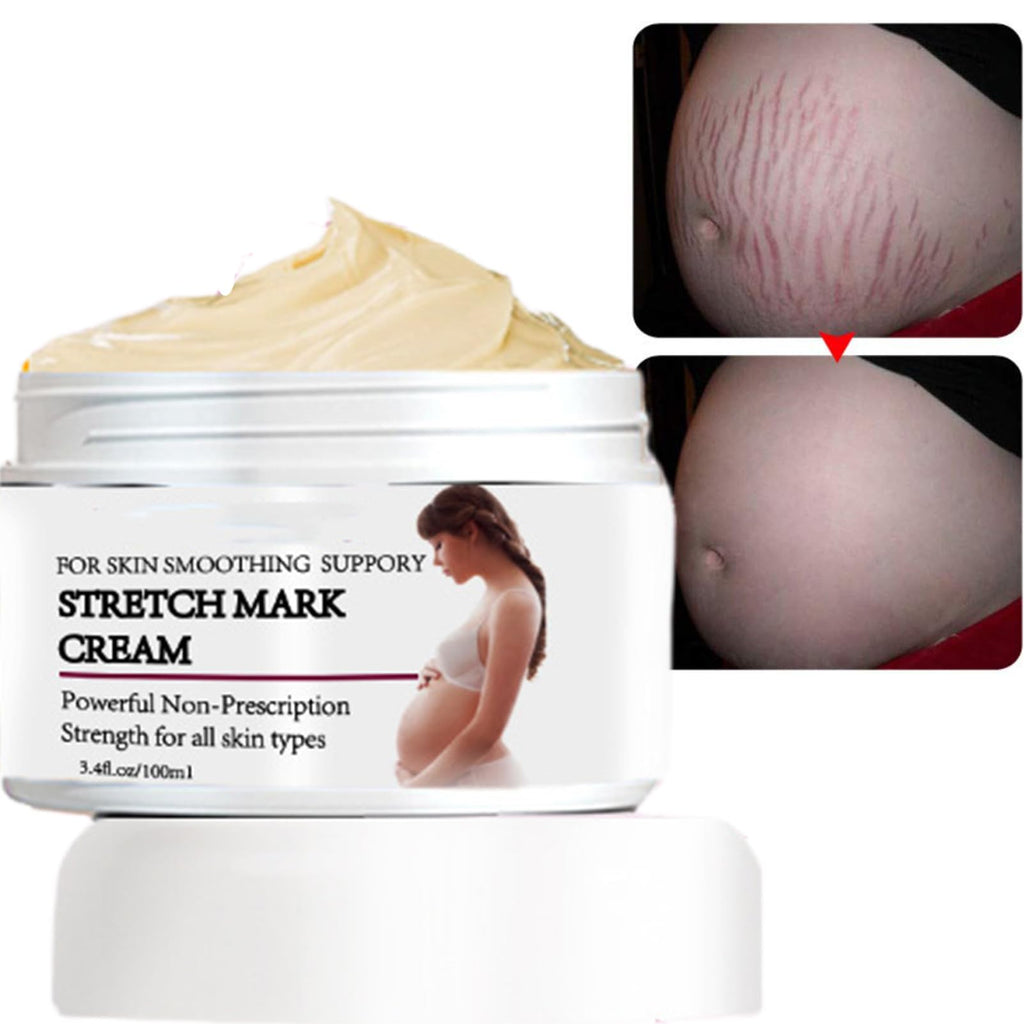 Stretch Mark Prevention Cream for Pregnancy, Stretch Mark Cream Remover, Stretch Mark Lotion for Pregnancy, Tummy Butter for Stretch Marks Pregnancy, Shea Butter Stretch Mark Removal Cream