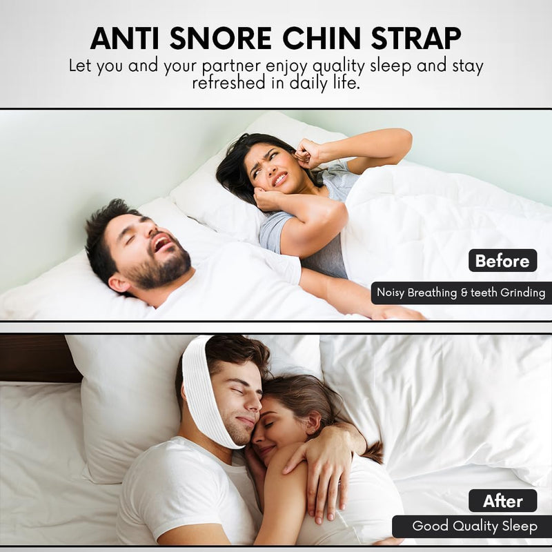 [Australia] - Super Deluxe White Chin Strap for Cpap Users - Anti Dry Mouth- Anti Snore Chin Strap Great Sleeping Solution for Men and Women to Keep Mouth Closed While Sleeping (1 pk) 1 pk 