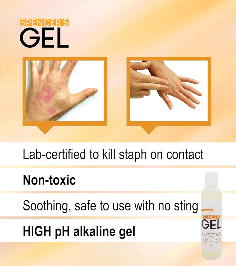 [Australia] - Spencer's Gel Alkaline Formula (8oz) Since 2004 The Only High-pH Solution for Stubborn Skin Issues (Boils, Furuncles, Ulcerations, Pressure Wounds, etc.) Non-Stinging, Fast-Acting 8 Fl Oz (Pack of 1) 