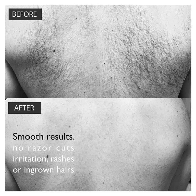 [Australia] - BALDAPE PARLOUR Body & Back Hair Removal Kit with Men's Depilatory Cream, Extendable Applicator & Loofah for Smooth, Hair-Free Results 