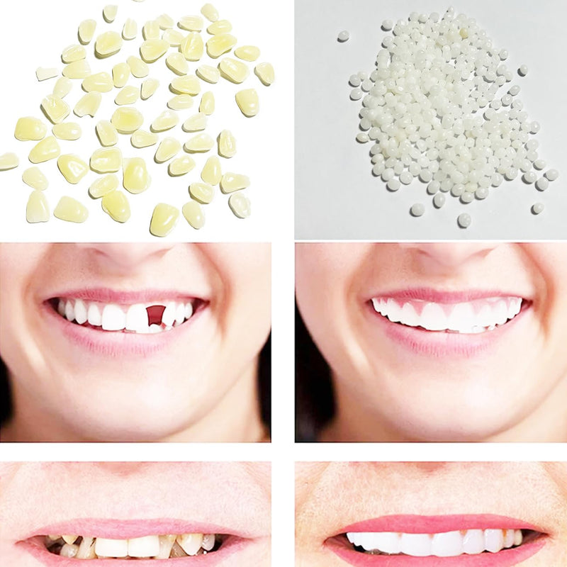 [Australia] - Tooth Repair Kit-Thermal Fitting Beads Granules and Fake Teeth for Temporary Fixing Missing and Broken Tooth，Replace a Missing Tooth in Minutes for Women and Man (Natural Yellow) 