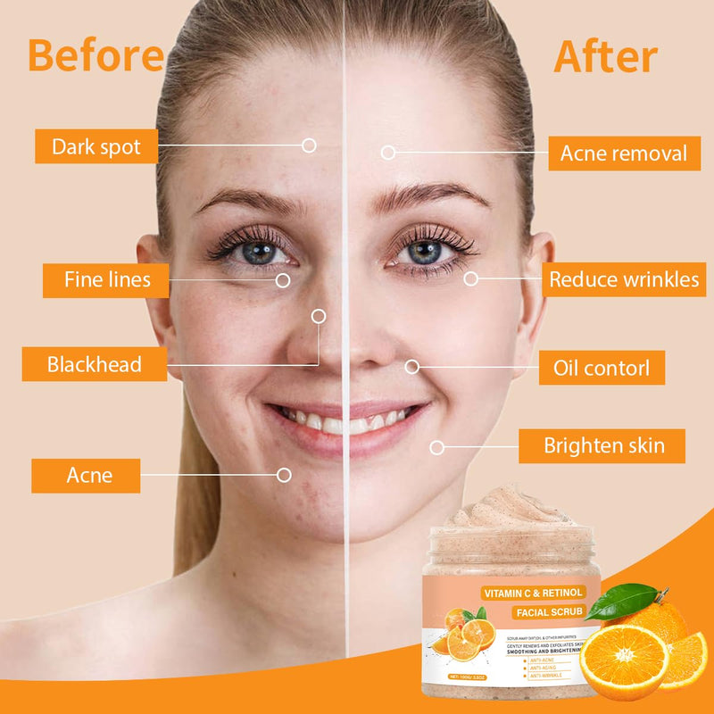 Vitamin C Face Scrub, Exfoliating Facial Wash with Retinol, Facial Scrub,Facial Exfoliating Scrub, Facial Scrubs for Women,Deep Cleansing Face Wash Cleanser for Women Men