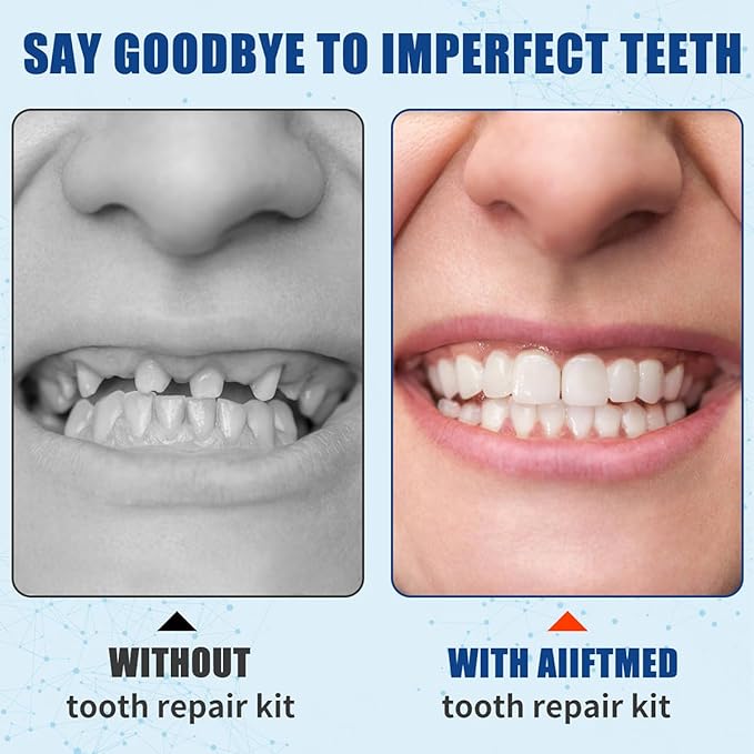 [Australia] - Teeth Repair kit,Tooth Filling Kit for Repair The Broken Teeth Gaps Crowns &Bridges Dental Care kit-A05 