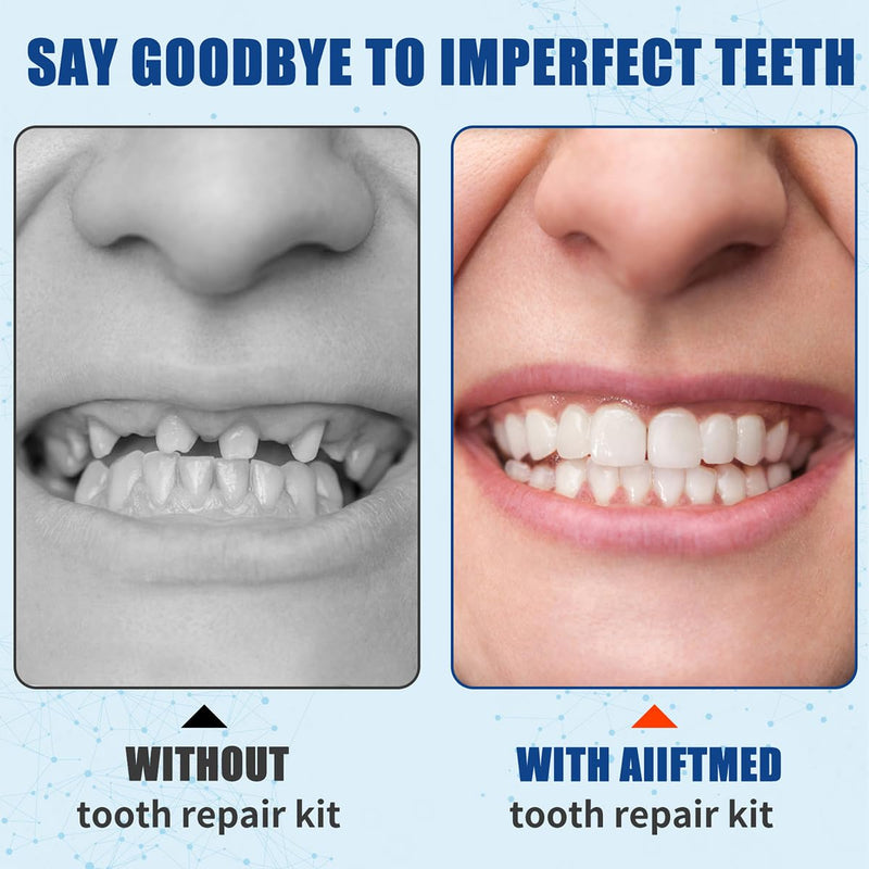 [Australia] - Tooth Repair Kit, Temporary Teeth Replacement Kit, Dental Care Kit Repair for Broken Chipped Teeth, Missing Teeth, Crown Fillings & Bridges, Make You Smile Confidently Again 