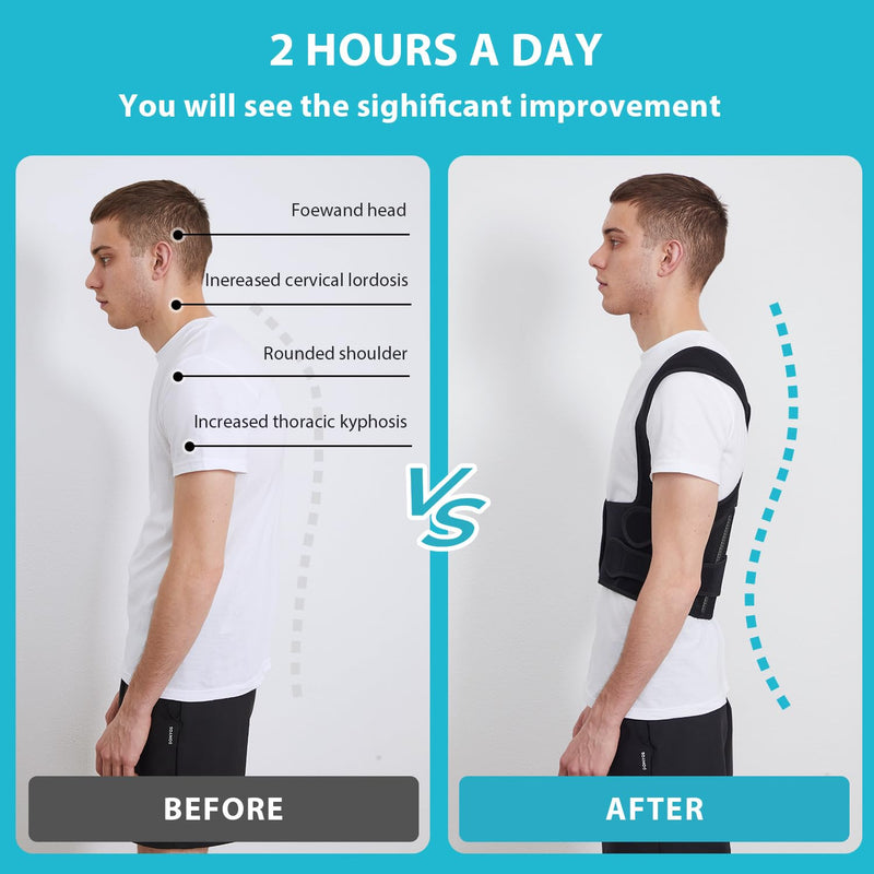 [Australia] - KD Back Brace Posture Corrector - Full Support for Women and Men - Straighten Shoulders, Relieve Upper and Lower Back Pain - Ideal for Scoliosis, Hunchback, Hump, Thoracic Issues (X-Large) X-Large 