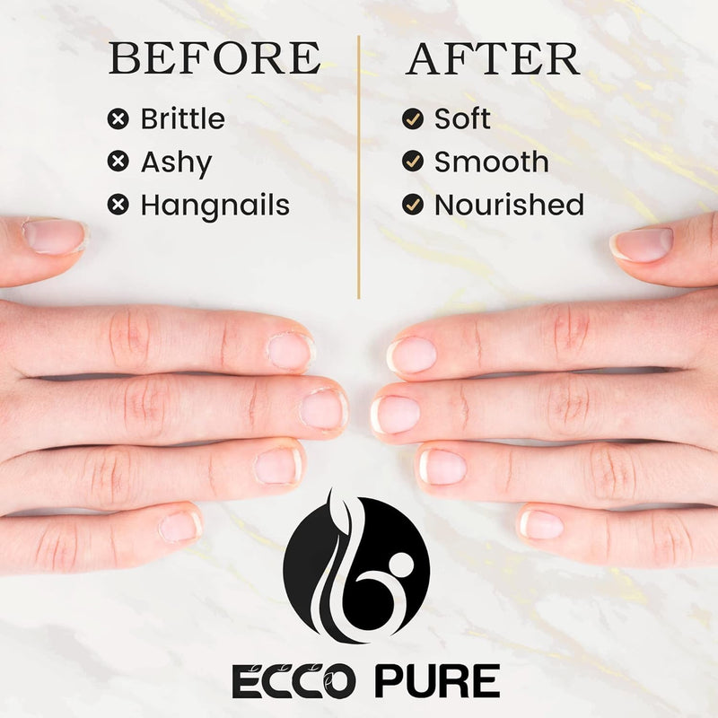 [Australia] - Cuticle Oil Foot Care ‚Äì Nourishes & Protects Nails and Cuticles ‚Äì Supports Healthy Toenails, Strength & Appearance ‚Äì Essential Daily Treatment Original 