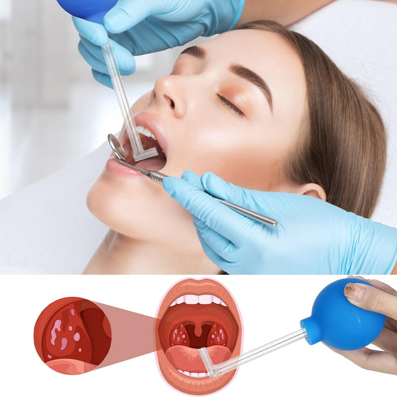 [Australia] - Riisoyu Tonsil Stone Removal Tool, Tonsilclin Tonsil Stone Cupping Glass with Suction Pipette Cupping Head Dental Mirror Tonsil Stone Remover for Bad Breath Oral Care Fresh Breath 