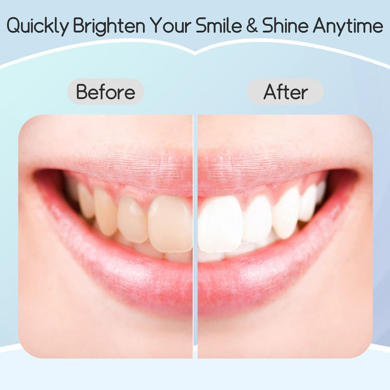 [Australia] - Teeth Whitening Strips Professional Effects Plus, Tooth Whitening Strips Safe Formulas Stain Removal, Deep Cleanse 7 Treatments, Suitable for Sensitive Teeth, Coffee, Smoke Stains 