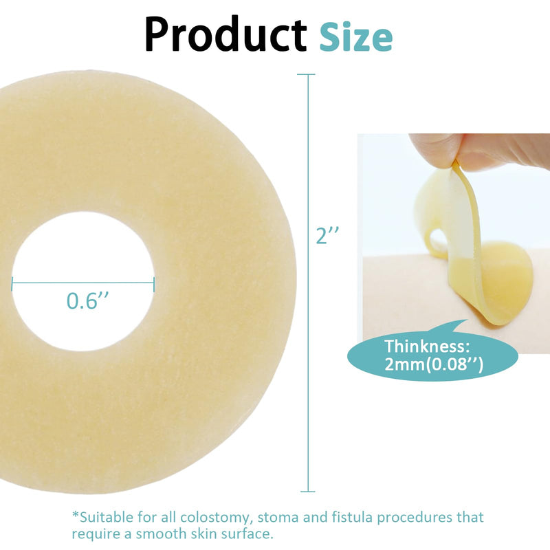 [Australia] - 20PCS Ostomy Barrier Rings, Medical Hydrocolloid Ostomy Supplies, Moldable Ostomy Ring, Leak-Free Skin Extender Rings, Stoma Protector Seal for Colostomy Bags 
