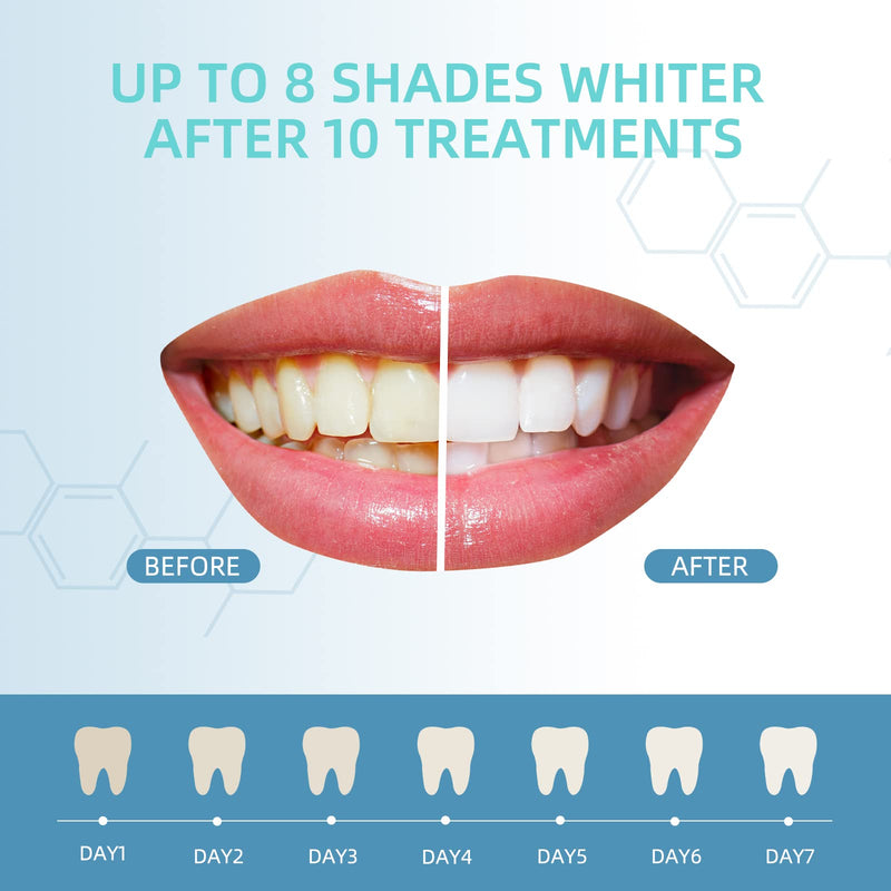 [Australia] - Teeth Whitening Gel Refills 10PCS Tooth Whitener 48+ Treatments -Removes Years of Stains 35% Carbamide Peroxide 