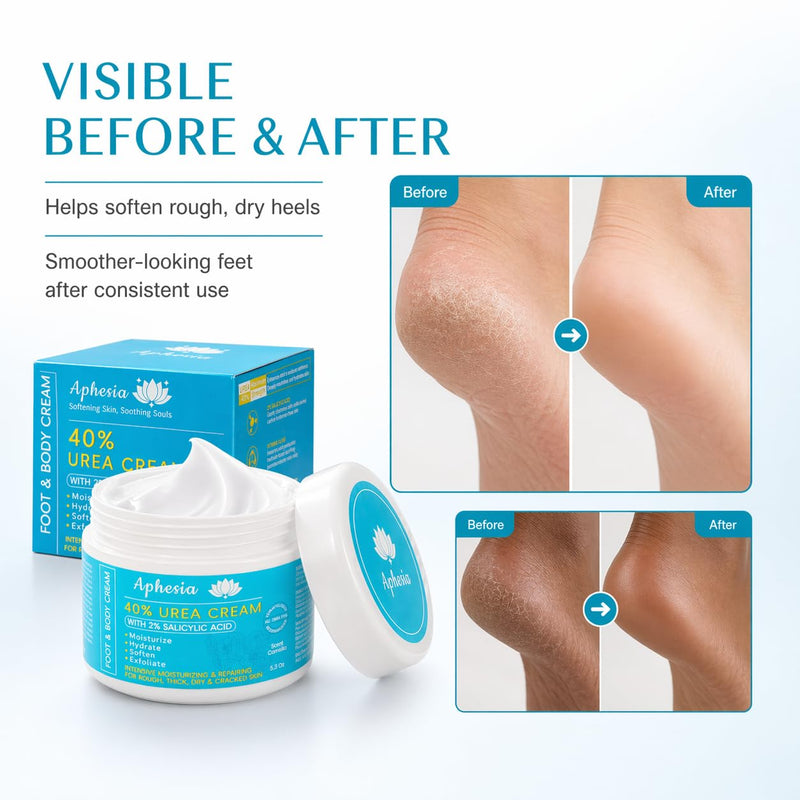 Urea Cream 40 Percent for Feet Maximum Strength w/ Vitamin E & 2% Salicylic Acid, Non-Greasy Formula Foot Cream for Summer Dry Cracked Heels - Intense Moisturizer Callus Remover for Hands, Foot, Body Camellia-Mild 5.3 Ounce (Pack of 1)