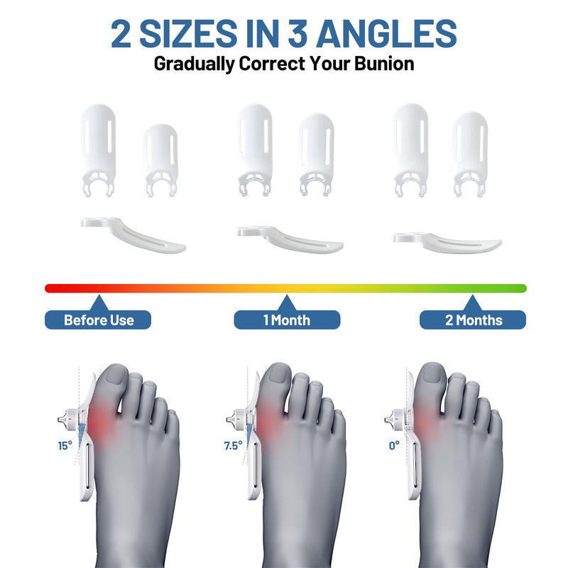 [Australia] - Bunion Corrector for Women & Men with Infinitely Adjustable Knob, Orthopedic Bunion Splint for Big Toe Suitable for Left/Right Feet Hallux Valgus Relief (1PCS) 
