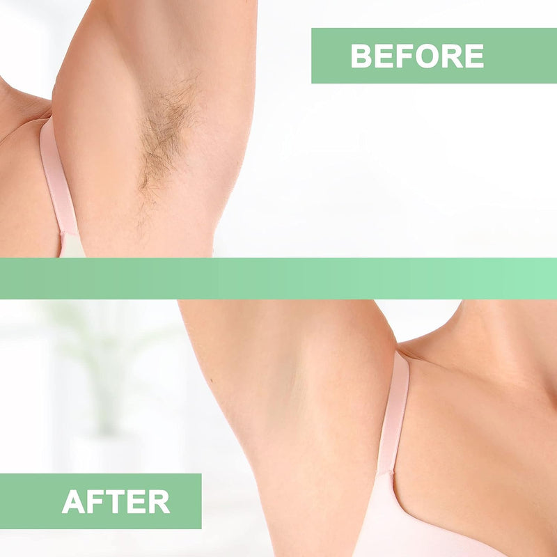 [Australia] - 150 Wax Strips - Non Woven Fleece Stripes For Warm Wax And Sugar Paste - Skin-friendly And Tear-resistant Hair Removal For Any Type Of Depilation On The Leg, Chest, Back, Intimate Area And Face 150 Wax Strips 