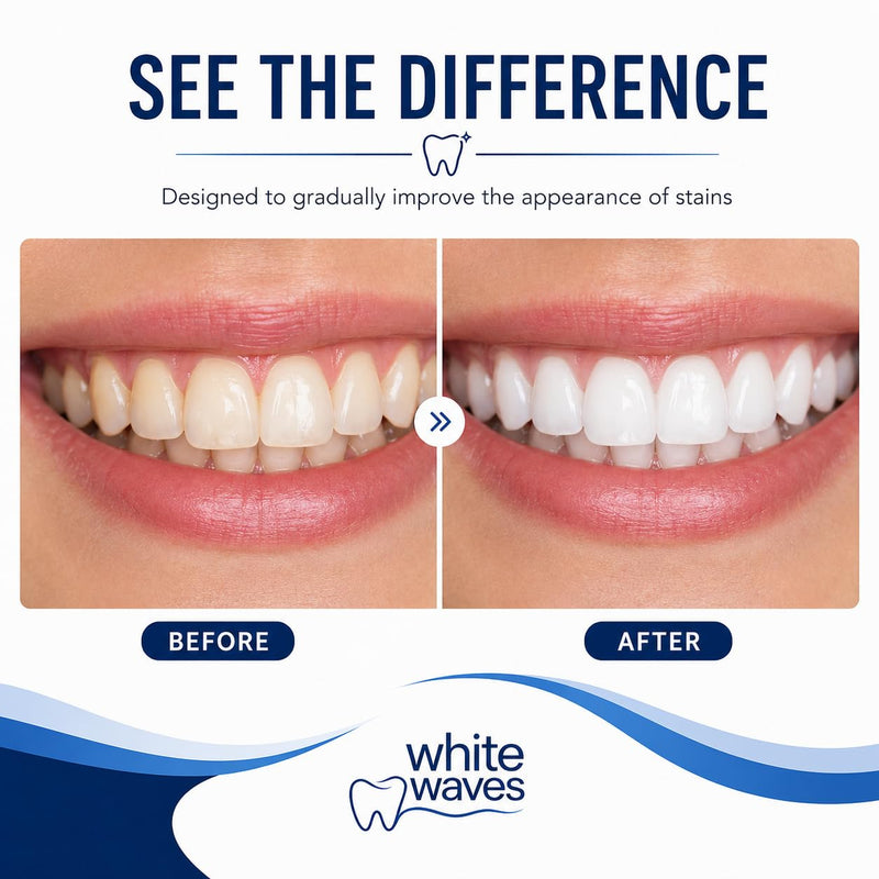 Teeth Whitening Kit with LED Light – Enamel-Safe Whitening Strips (14 Treatments) – White Waves At-Home Whitening System