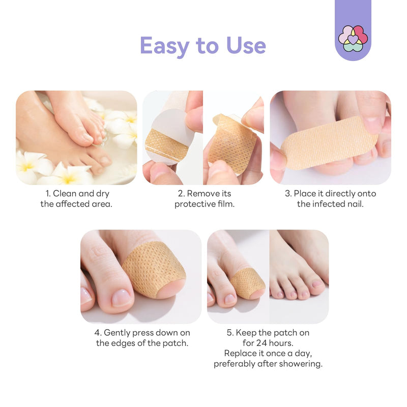 SAVILAND Fungal Nail Patches for Overnight 1% Tolnaftate Nail Repair 64Pcs | FSA-HSA, 8H Deep Overnight Repair, Reduces Yellow & Thick Nails, Breathable Materials Adhere Securely, Damaged Toenail Care 2 Pcs