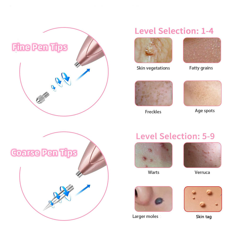 [Australia] - CHRERNA Birthmark Removal Pen, Wart Removal Pen with 9 Strength Safe and LCD Screen Plasma Pen Device for Hand and Body (Nevus, Birthmarks, Pigment Spots, Age Spots) Pink 