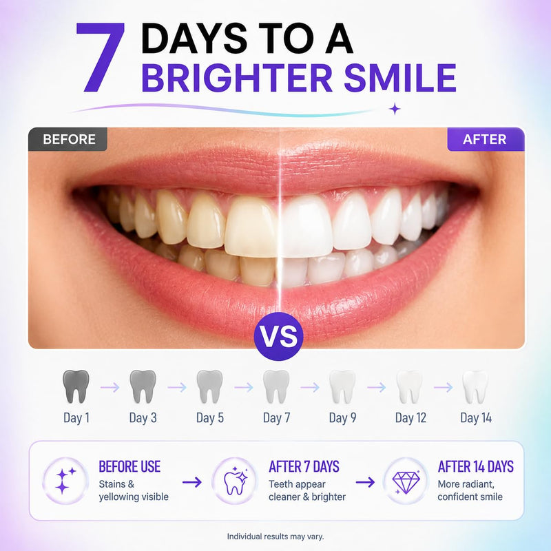 Teeth Whitening Strips for Sensitive Teeth, Peroxide Free with Nano Hydroxyapatite, Enamel Safe Stain Remover, 14 Treatments (28 Strips), Fresh Mint