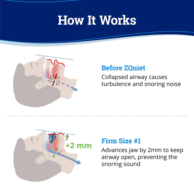 [Australia] - ZQuiet, Anti-Snoring Mouthpiece, Firm Size #1, Strong & Durable Mouthguard, Ideal for Those Prone to Teeth Grinding & Clenching, Made in USA, Size 1 