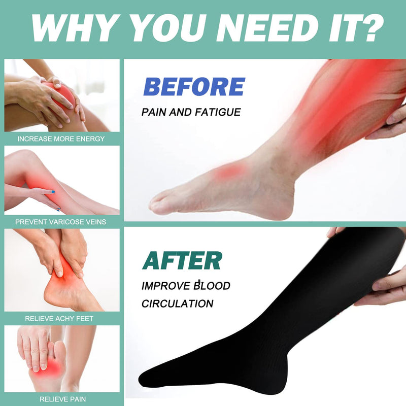 [Australia] - 8 pairs of compression stockings for women and men, compression socks, support stockings (15-20 mmHg) for running, travel, sports, flights, pregnancy, maternity, cycling, nurses S-M Assortment 01 (8 pairs) 
