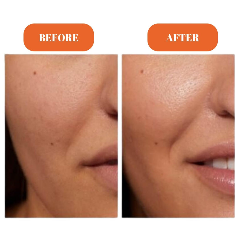 Radiance Maximising Vitamin C Serum - 10% Pure Stable Vitamin C Face Serum for Glowing Skin - Non-Sticky, Fast Absorbing Brightening & Anti-Aging Formula - No Pilling Under Makeup - 30ml