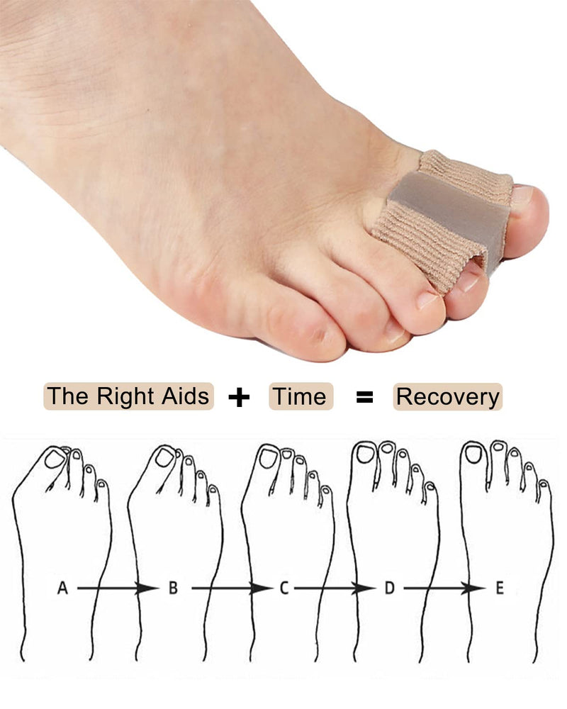 [Australia] - Bunion Toe Separators for Overlapping Toes Women Men, Gel Toe Spacers Bunion Corrector with 2 Loops for feet, Hammer Toe Straightener(2PC) 2pc 