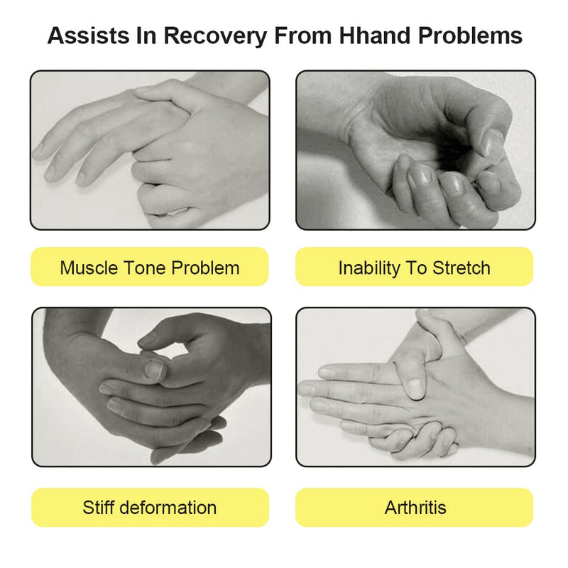 Resting Hand Straighten Splint - Night Finger Separator Support Rehab Training Support Supplies for Arthritis, Spasm (Right) Right