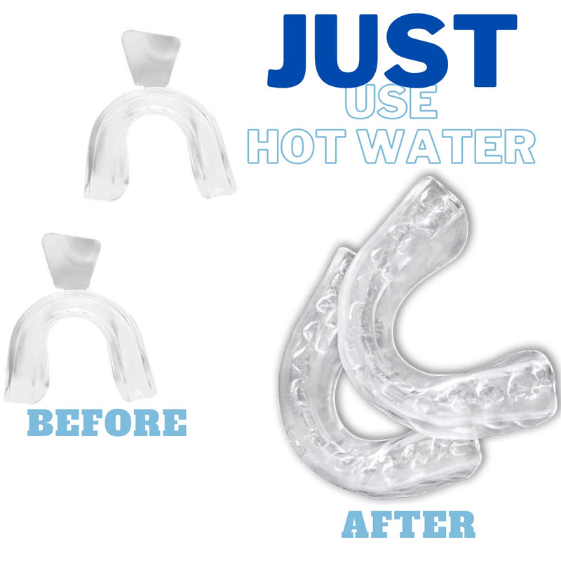 [Australia] - Teeth Whitening Gel Refills 5 Pack Teeth Whitening Trays Included Remove Tooth Stains Enamel Safe Gluten Free 44% Carbamide Peroxide Gels Vegan and Alcohol Free Fast Acting Teeth Whitener BPA Free 