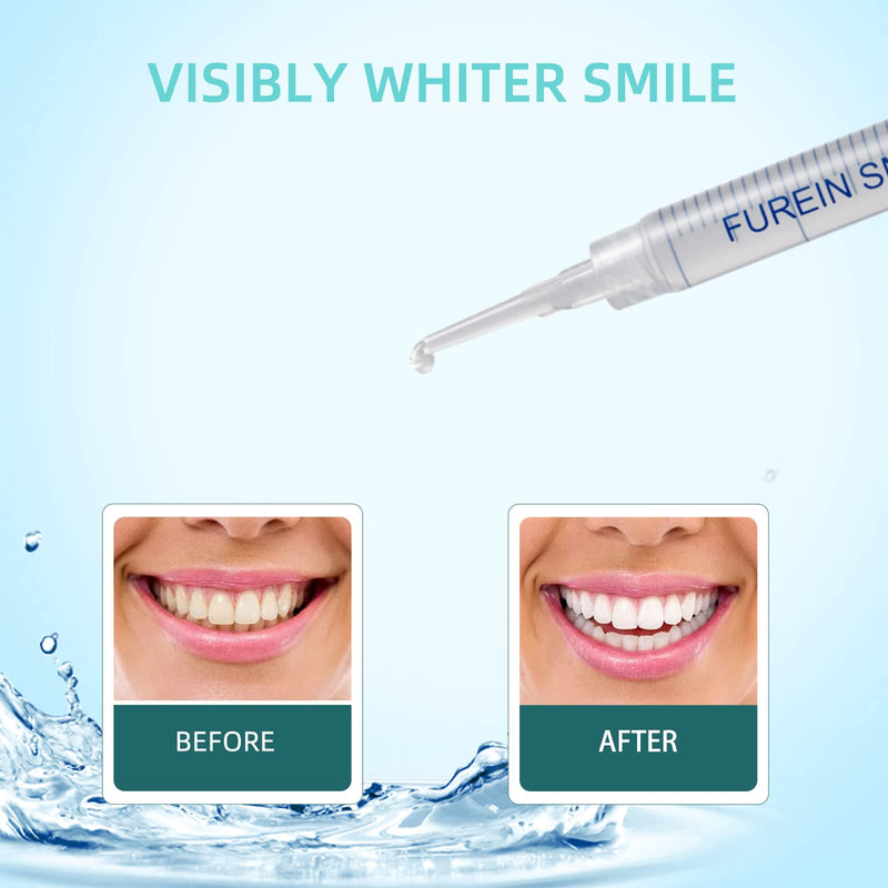 [Australia] - Teeth Whitening Gel Refills 10PCS Tooth Whitener 48+ Treatments -Removes Years of Stains 35% Carbamide Peroxide 