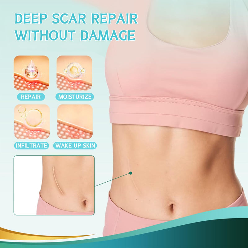 [Australia] - Volhuluk Transparent Silicone Scar Plaster (4x150cm), Silicone Plaster Professional for C-Section Scars, Operations, Burns, Keloid, Acne and More, Silicone Plaster for Scars 