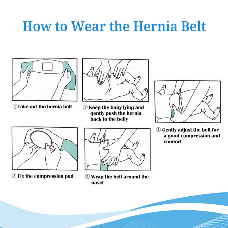 [Australia] - S Baby Belly Band Umbilical Hernia Belt | Belly Button Band Navel Truss Wrap for Newborn/Infant - Soft, Skin-friendly, Adjustable Blue/White 